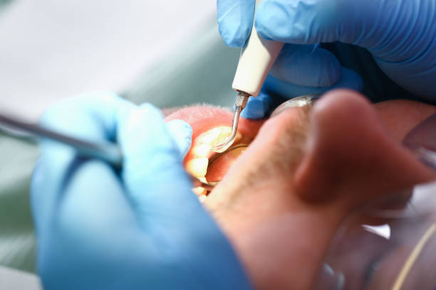 Best Emergency Root Canal Treatment in Lake Odessa, MI